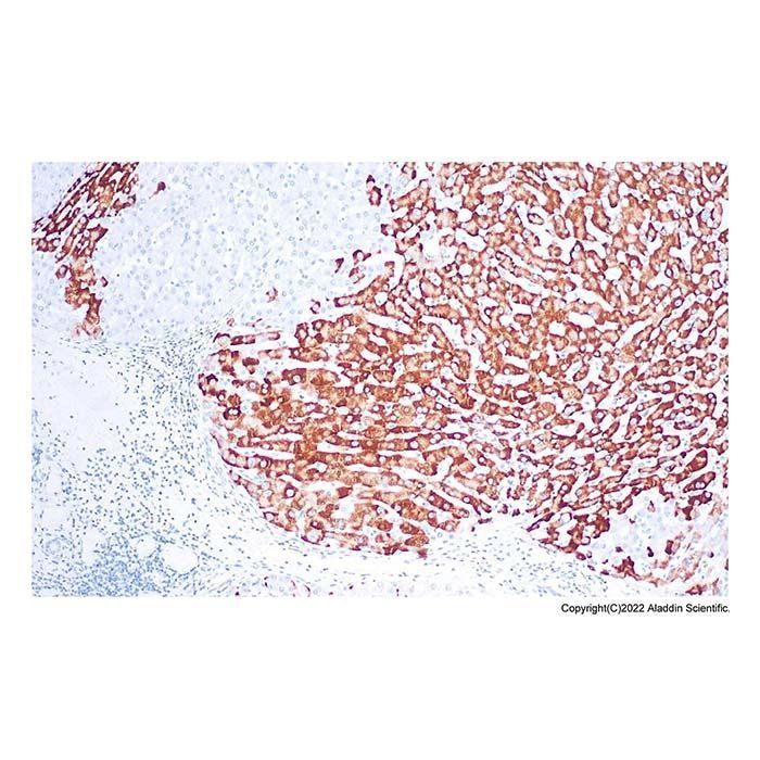 Recombinant Hepatitis B Virus Surface Antigen (Ad/Ay) Antibody -    by Aladdin Scientific