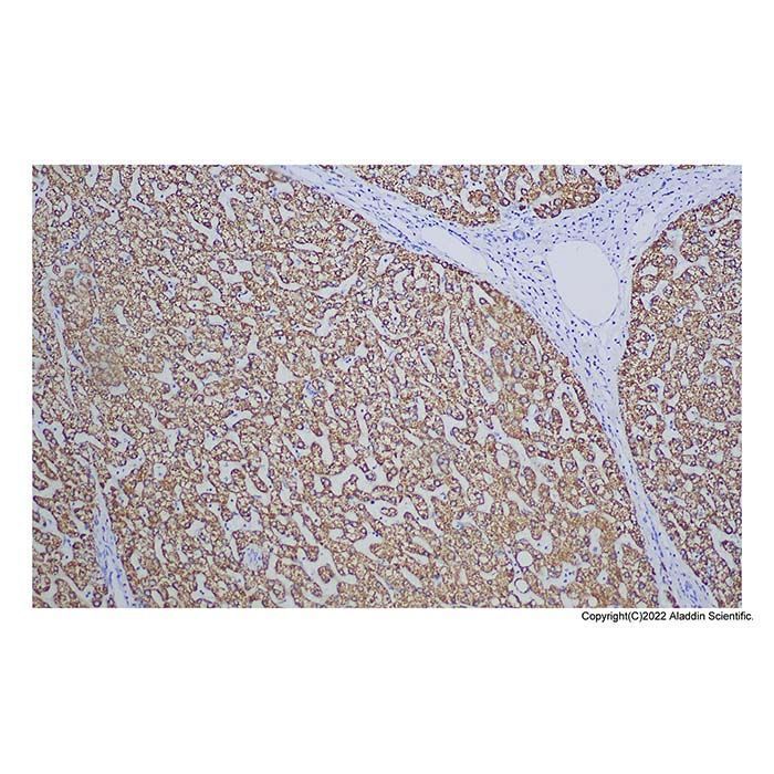 Recombinant Hepatocyte Specific Antigen Antibody -    by Aladdin Scientific