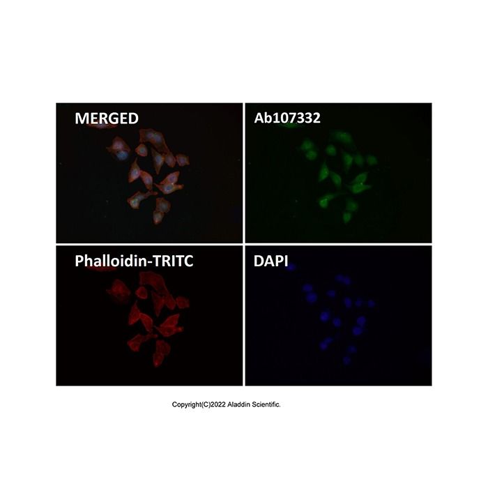 Recombinant Hes1 Antibody -    by Aladdin Scientific