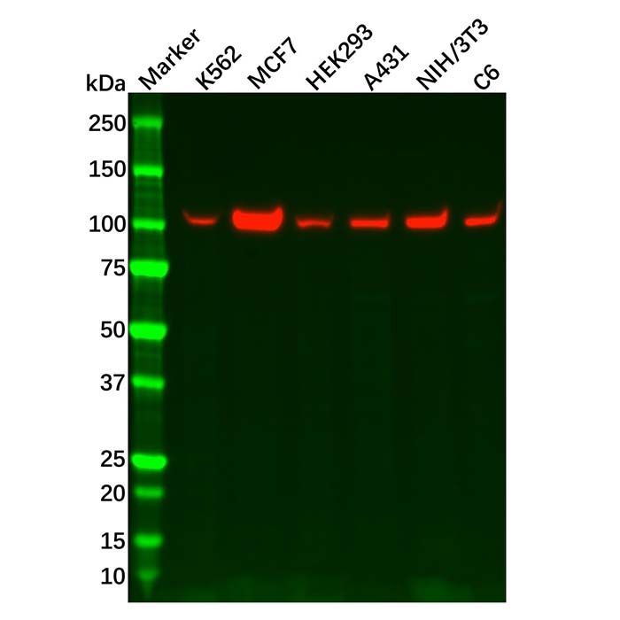 Recombinant Hexokinase 1 Antibody -    by Aladdin Scientific