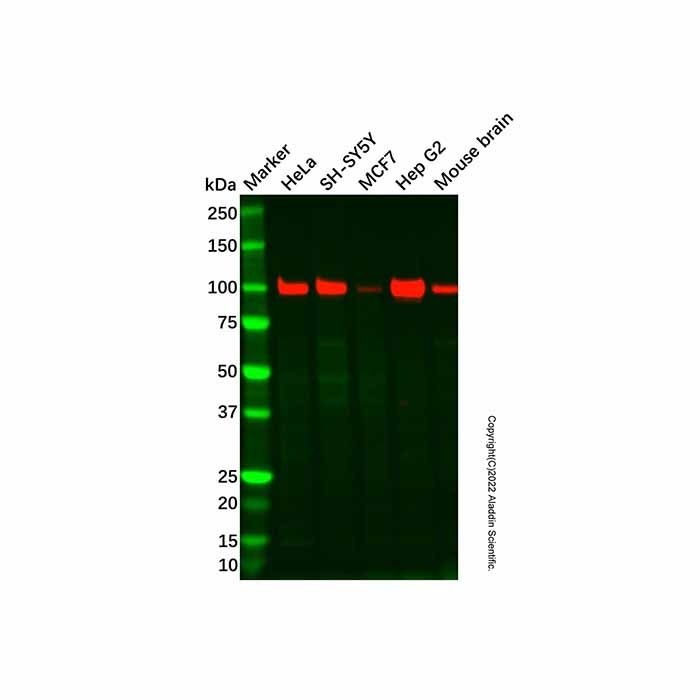 Recombinant Hexokinase II Antibody -    by Aladdin Scientific