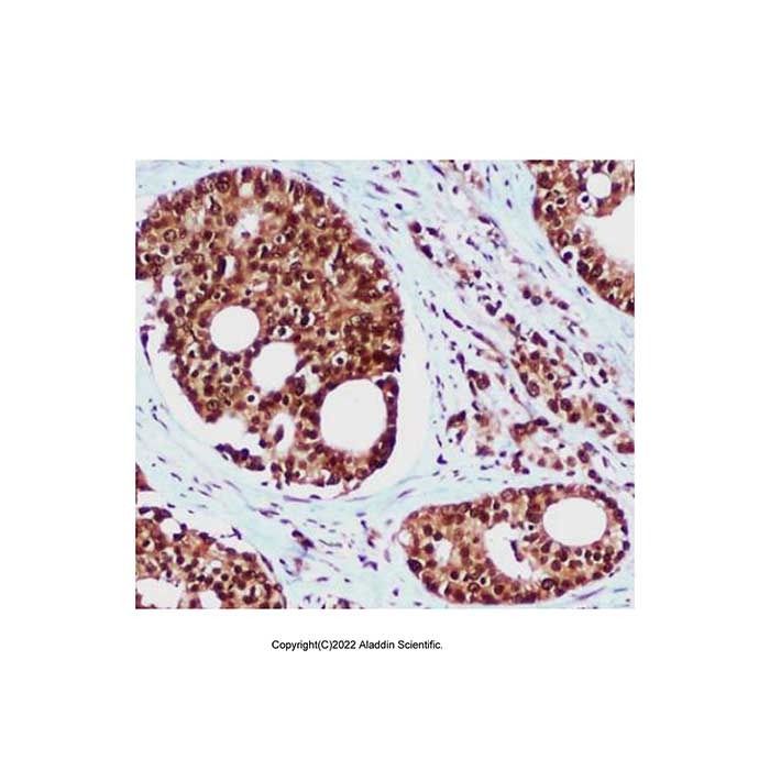 hHR23b Mouse mAb -    by Aladdin Scientific
