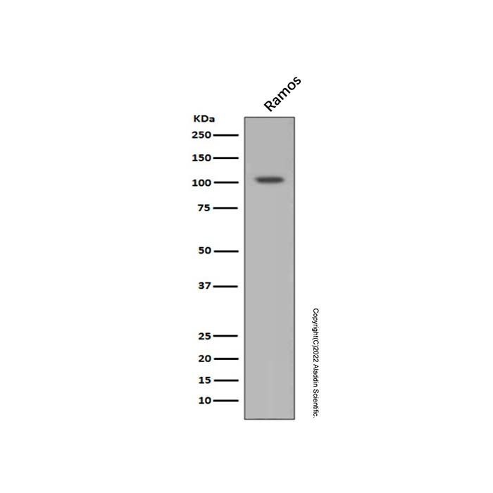 Recombinant HIF-1 alpha Antibody -    by Aladdin Scientific
