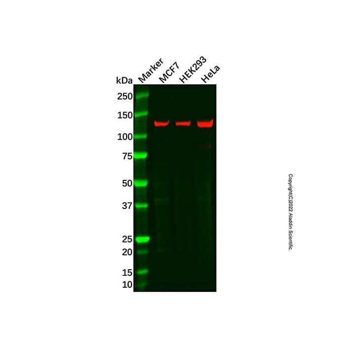 HIP1R Antibody -    by Aladdin Scientific