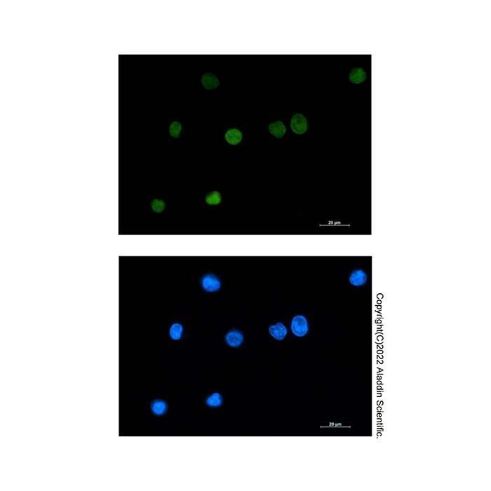 Recombinant Histone H1.2 Antibody -    by Aladdin Scientific
