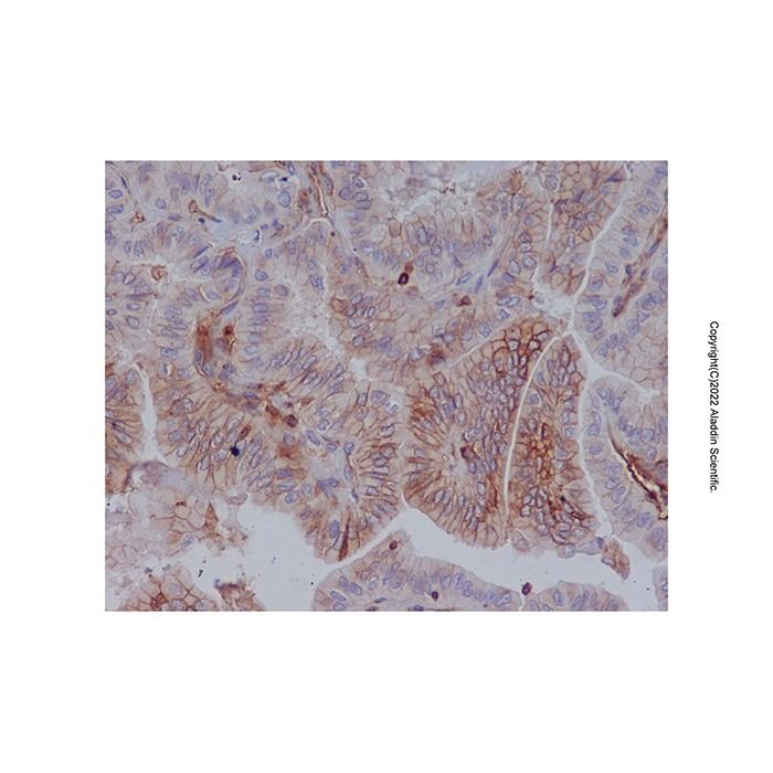 Recombinant HLA A Antibody -    by Aladdin Scientific