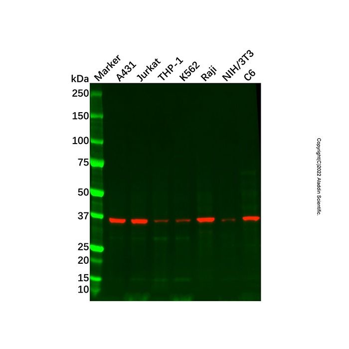 HLA E Antibody -    by Aladdin Scientific