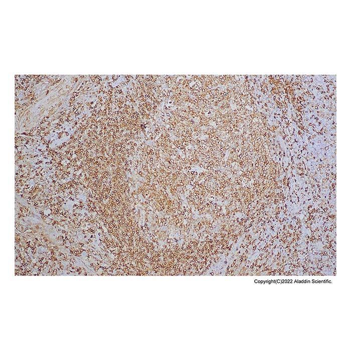 Recombinant HLA-DR Antibody -    by Aladdin Scientific