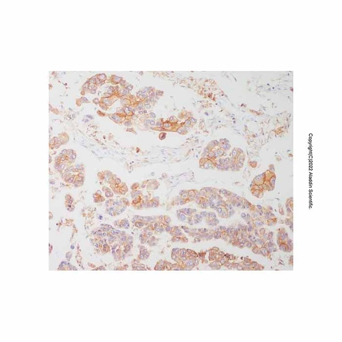 Recombinant HLA-DR Antibody -    by Aladdin Scientific