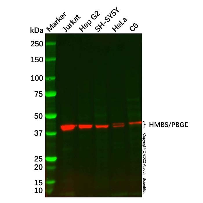 Recombinant HMBS/PBGD Antibody -    by Aladdin Scientific