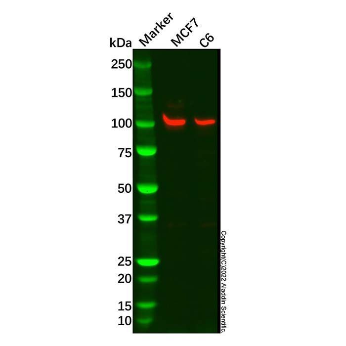 Recombinant HMGCR Antibody -    by Aladdin Scientific