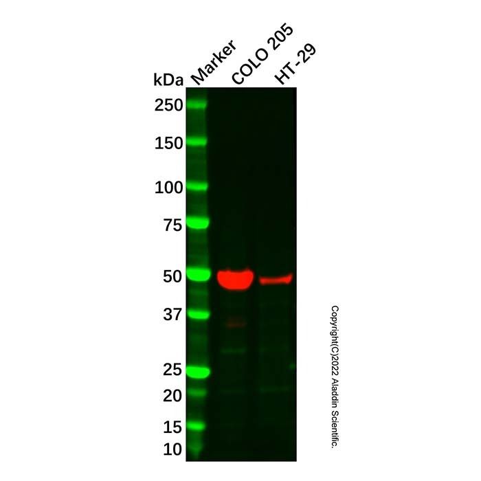 Recombinant HMGCS2 Antibody -    by Aladdin Scientific