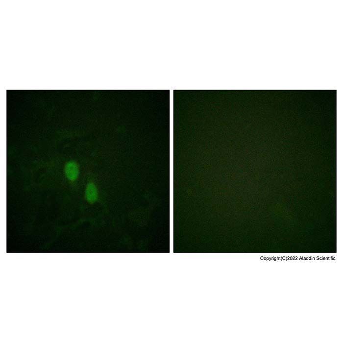 hnRNP D/AUF1 Antibody -    by Aladdin Scientific