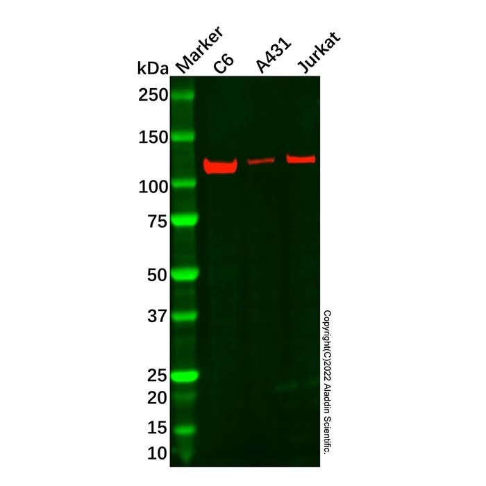 Recombinant hnRNP U/p120 Antibody -    by Aladdin Scientific