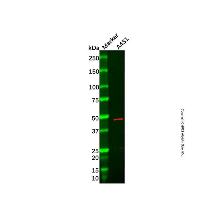 Recombinant HOXA13 Antibody -    by Aladdin Scientific