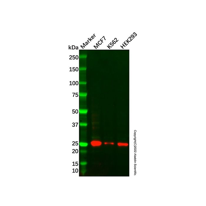 Recombinant HOXB9 Antibody -    by Aladdin Scientific