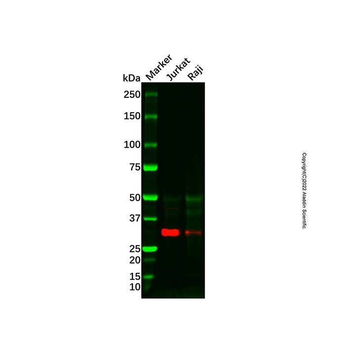HOXD13 Antibody -    by Aladdin Scientific