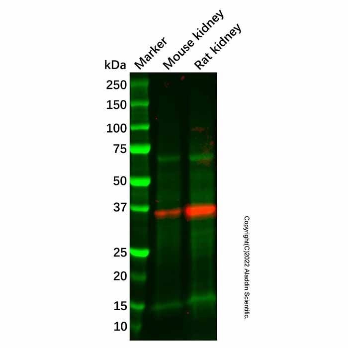 Recombinant HSD11B1 Antibody -    by Aladdin Scientific