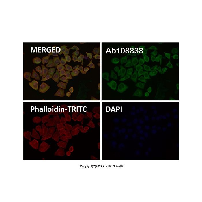 Recombinant Hsp27 Antibody -    by Aladdin Scientific