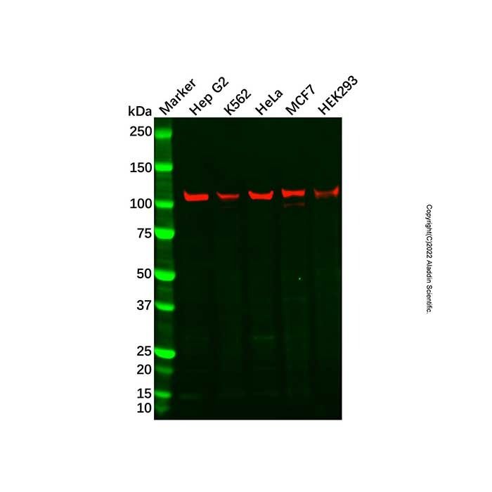 Recombinant HSPA4 Antibody -    by Aladdin Scientific