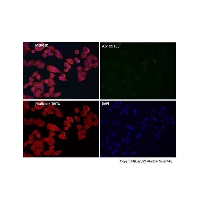 Recombinant HuR/ELAVL1 Antibody -    by Aladdin Scientific