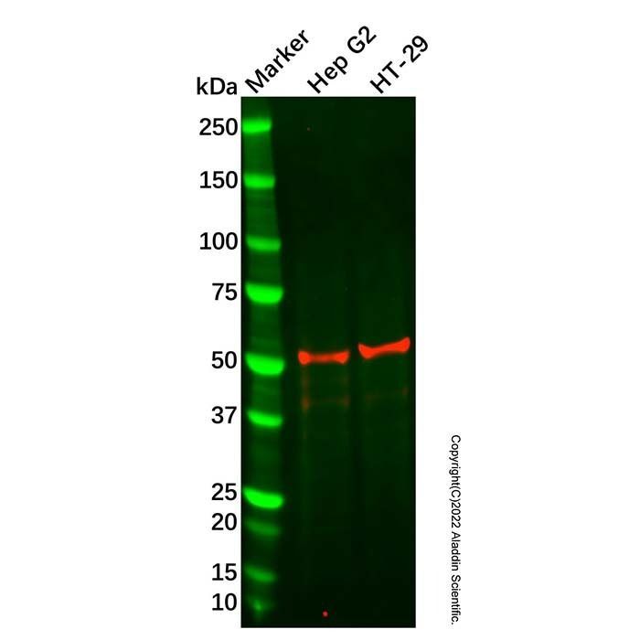 Recombinant Hydrogen Potassium ATPase Beta/ATP4B Antibody -    by Aladdin Scientific