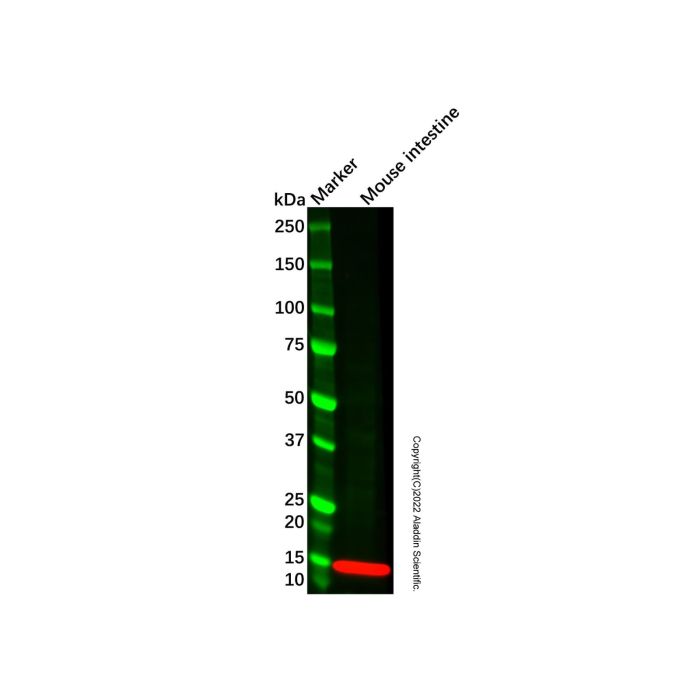 Recombinant I-FABP Antibody -    by Aladdin Scientific