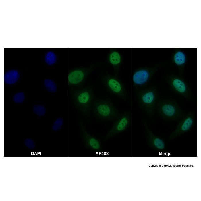 IFI35 Antibody -    by Aladdin Scientific