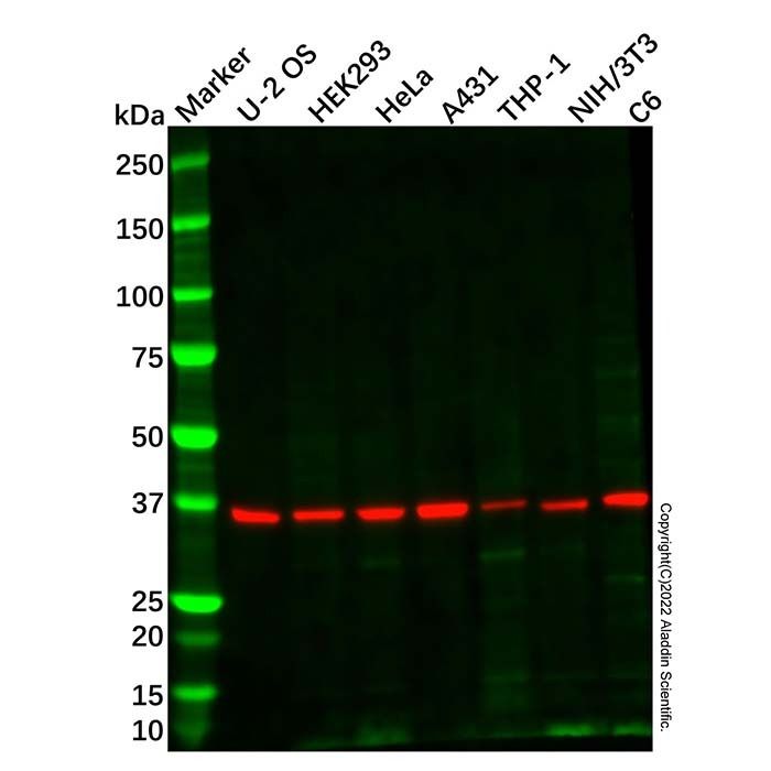 IFN gamma Receptor beta/AF-1 Antibody -    by Aladdin Scientific