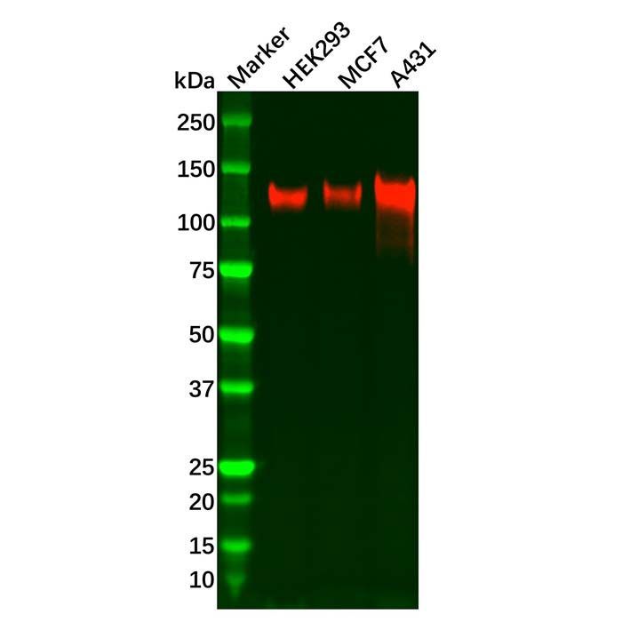Recombinant IGF1 Receptor Antibody -    by Aladdin Scientific