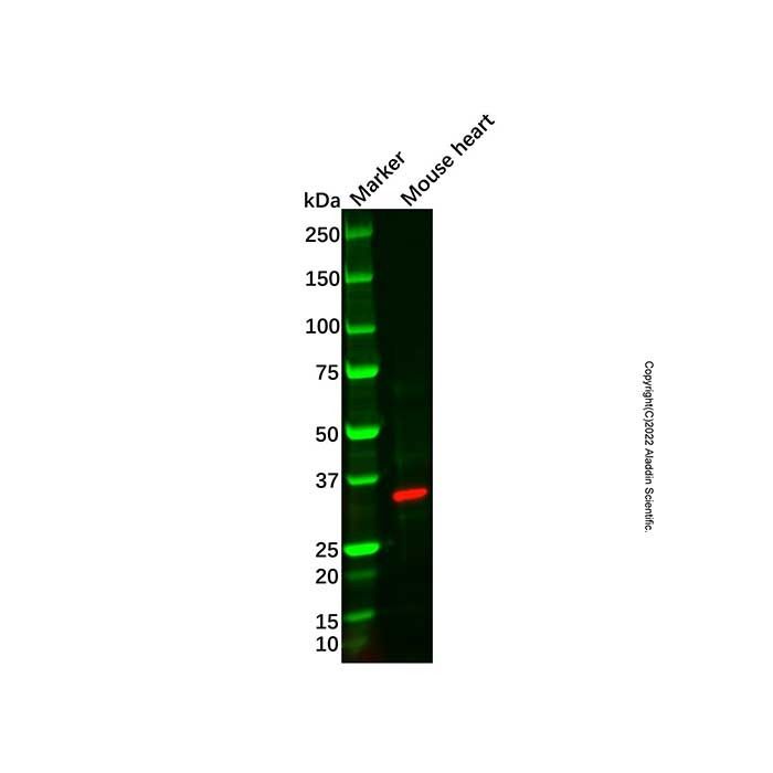 Recombinant IGFBP1 Antibody -    by Aladdin Scientific