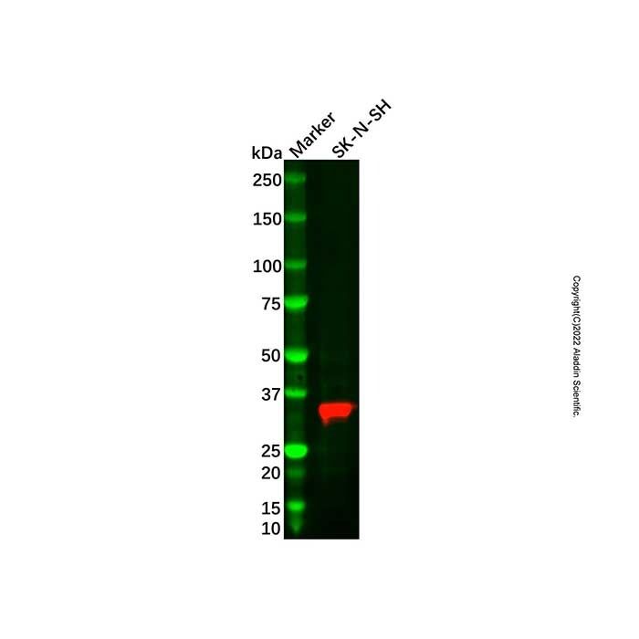 Recombinant IGFBP2 Antibody -    by Aladdin Scientific