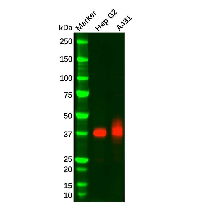 IGFBP3 Mouse mAb -    by Aladdin Scientific