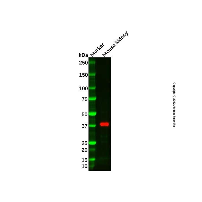 Recombinant IGFBP7 Antibody -    by Aladdin Scientific