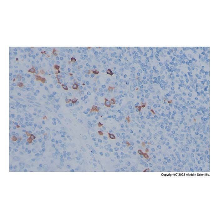 Recombinant IgG4 Antibody -    by Aladdin Scientific