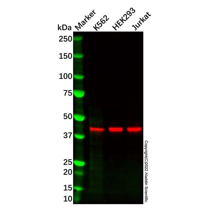 Recombinant IKB beta Antibody -    by Aladdin Scientific