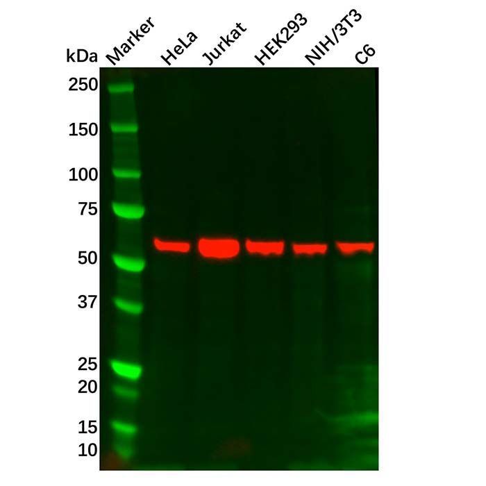 IL10RB Mouse mAb - by Aladdin Scientific