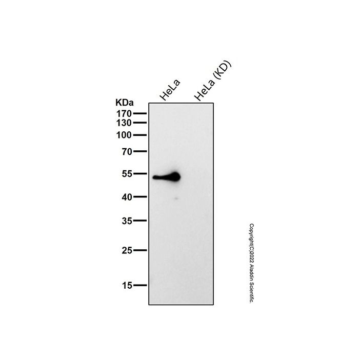 Recombinant IL-13 receptor alpha 1 Antibody -    by Aladdin Scientific