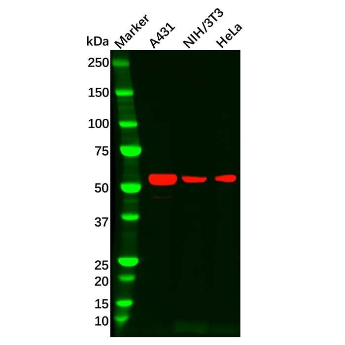IL-13 receptor alpha 1 Antibody -    by Aladdin Scientific
