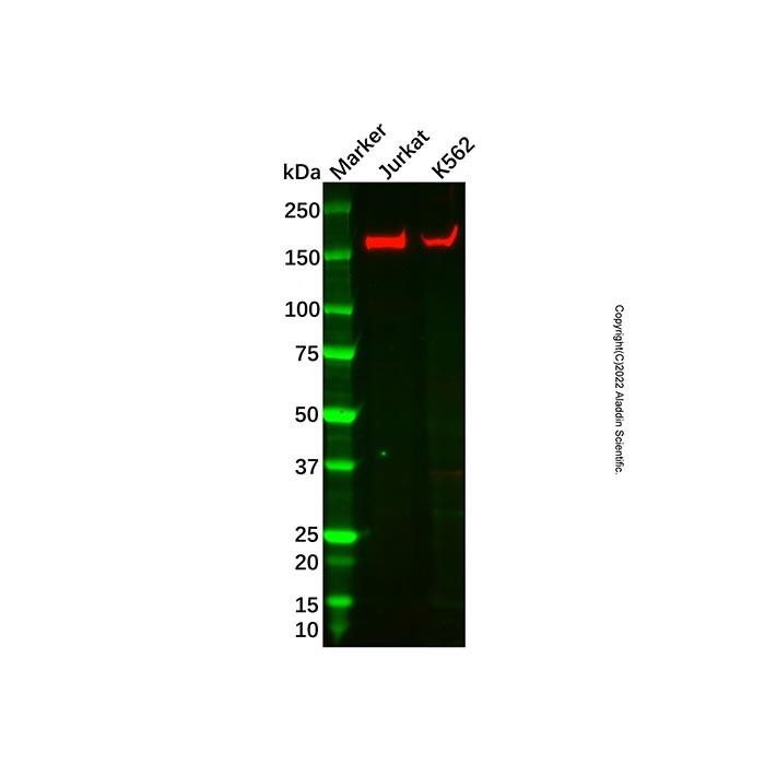 Recombinant IL-17RA Receptor Antibody -    by Aladdin Scientific