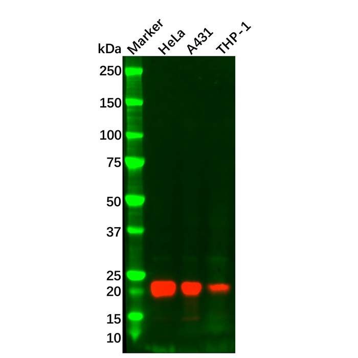 IL-18 Mouse mAb -    by Aladdin Scientific