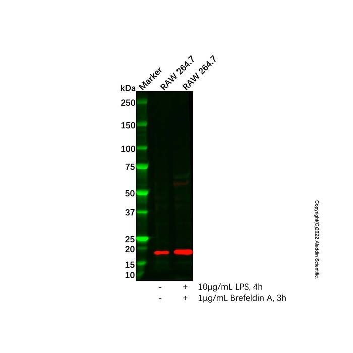 IL-6 Antibody -    by Aladdin Scientific