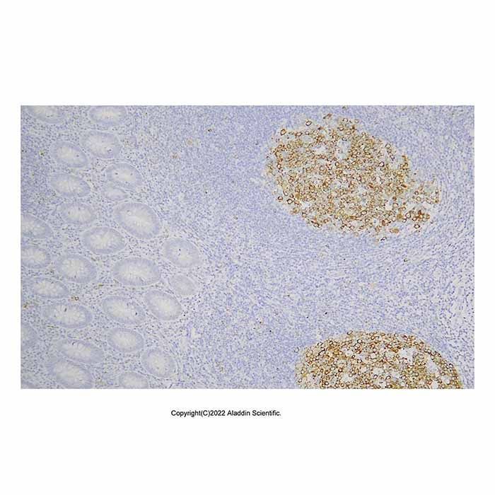 Recombinant IMP3 Antibody -    by Aladdin Scientific