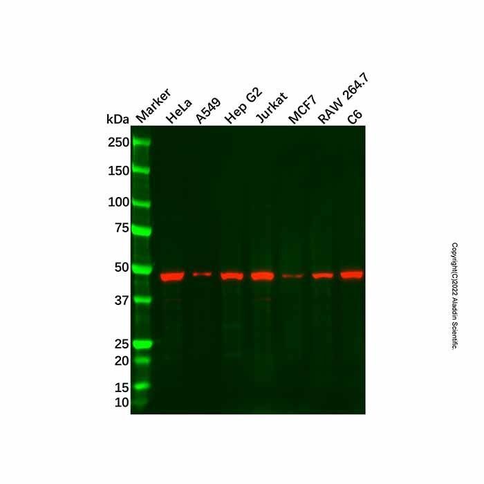 Recombinant ING1 Antibody -    by Aladdin Scientific