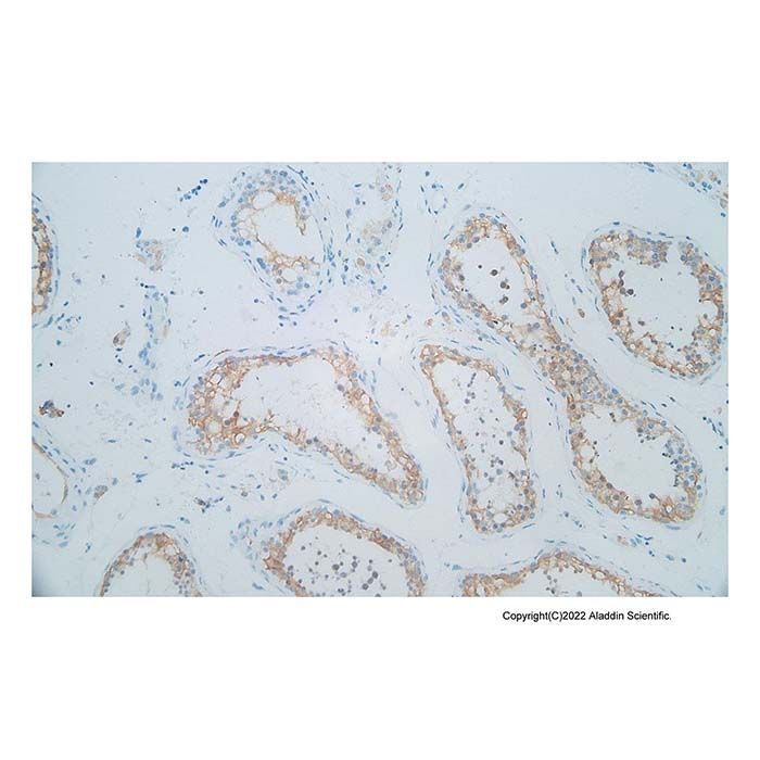 Recombinant Inhibin alpha Antibody - by Aladdin Scientific