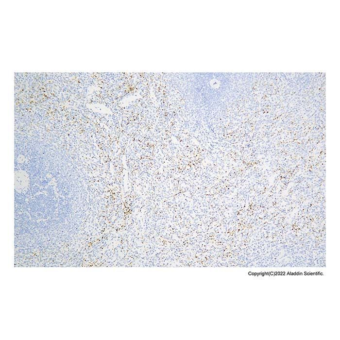 Recombinant Integrin beta 3 Antibody -    by Aladdin Scientific