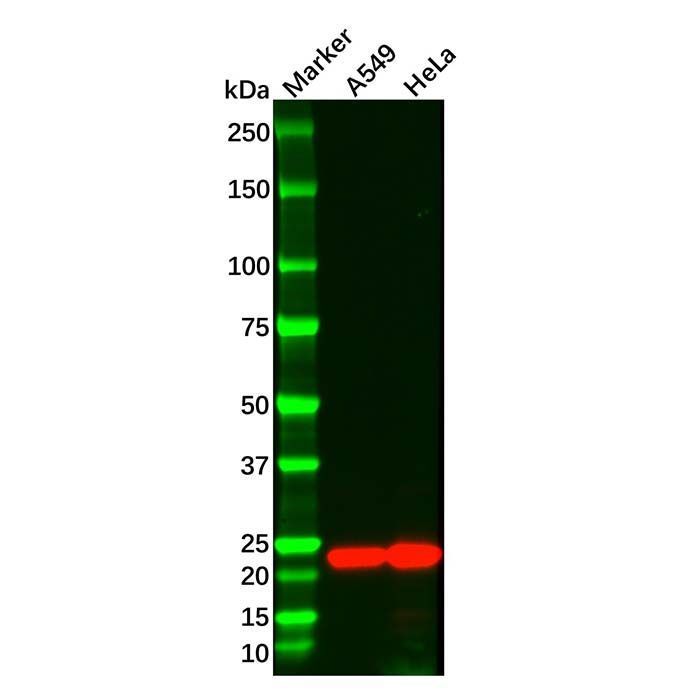 Recombinant Interferon beta Antibody -    by Aladdin Scientific