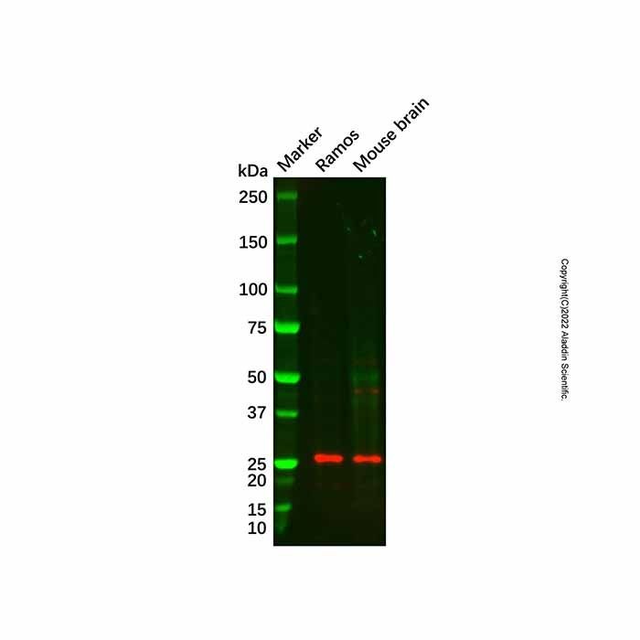 Recombinant Interferon gamma Antibody -    by Aladdin Scientific