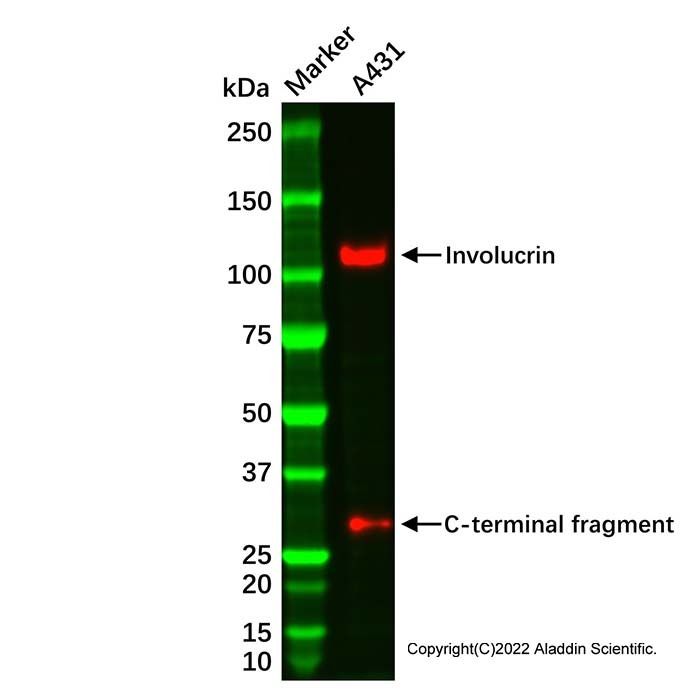 Involucrin Antibody -    by Aladdin Scientific
