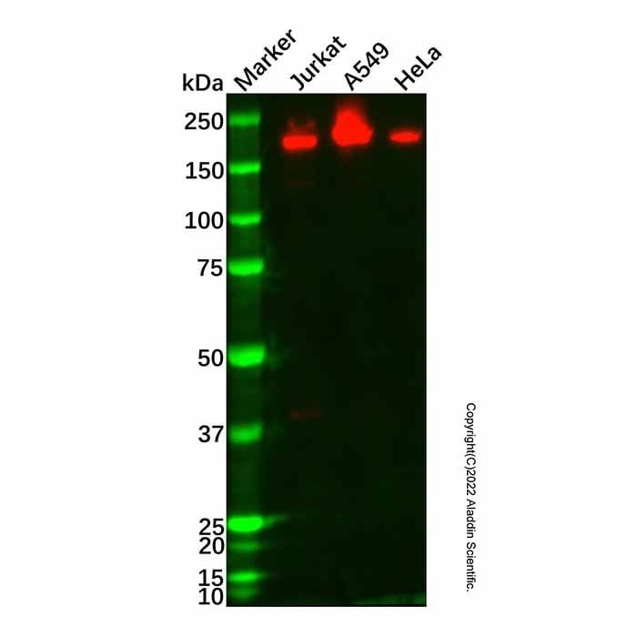Recombinant IQGAP2 Antibody -    by Aladdin Scientific
